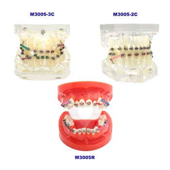 Dantų ortodontinio gydymo dantų modelis su metaliniais laikikliais Arkiniai laidai Kaklaraiščiai ortodontinio mokymo restauravimo praktikai
