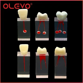 OLEVO dantų modelis endo blokas endodontinis RCT šaknų kanalų dantų mokymo modeliai Dervos odontologo mokymo priedai