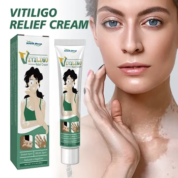 vaistažolių ekstraktas Vitiligo tepalas Pašalinti grybelis Baltos dėmės pašalinimas Odos priežiūra Vitiligo Pašalinkite Vitiligo gydomąjį kremą